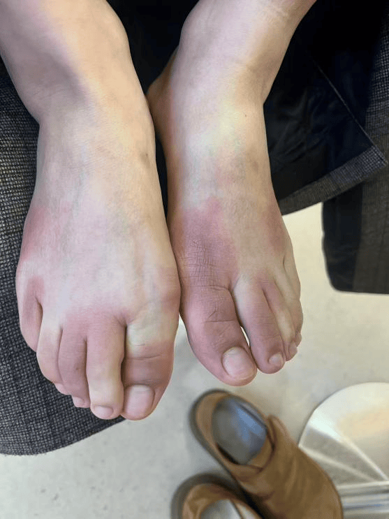 皇冠mos066
_东北姑娘来浙江后崩溃了皇冠mos066
,穿3条加绒裤还冻到发抖!南方人冬天怎么保命,网友吵翻!