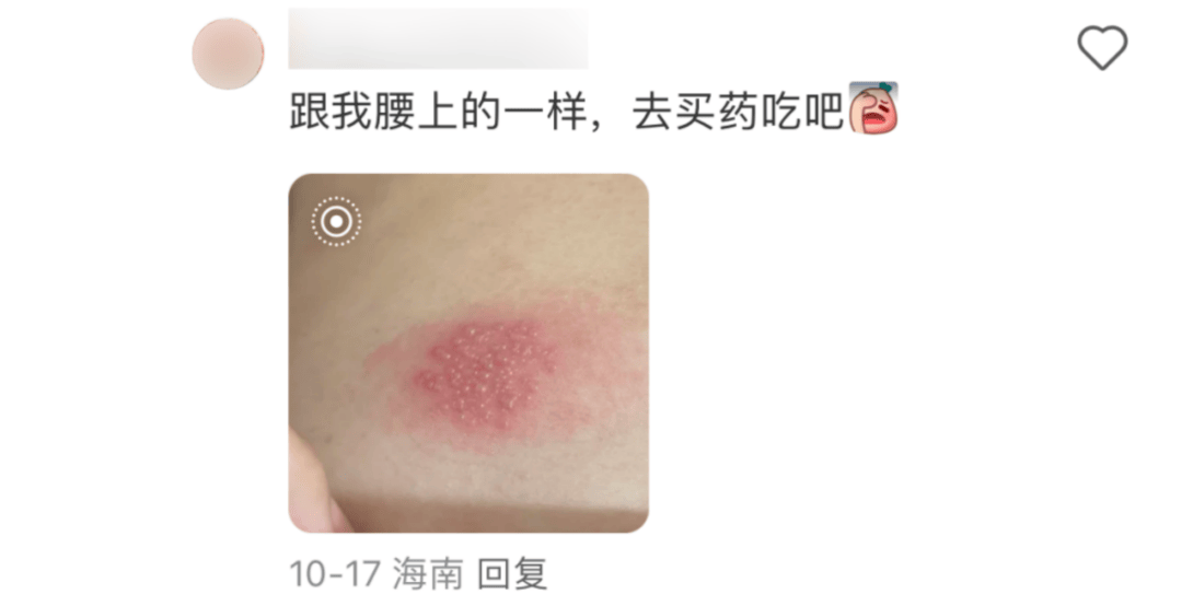 皇冠信用网会员开户_一旦感染终身携带皇冠信用网会员开户！深圳疾控提醒：这4类人要注意